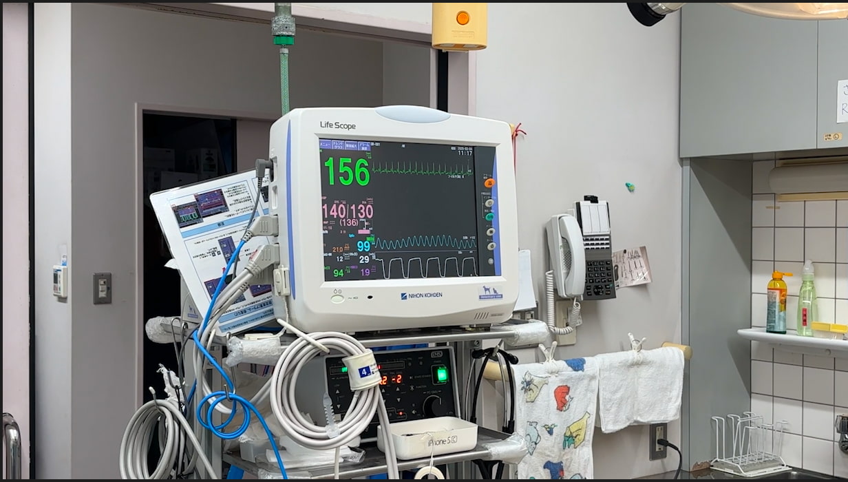 心電計